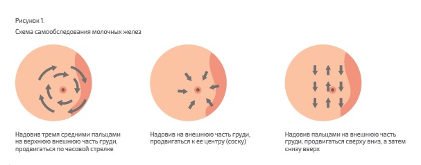 Дисплазия молочной железы презентация